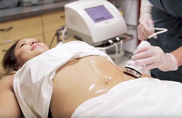 Ultrasound Cavitation Ultrasound Cavitation